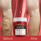 AUQUEST Varicose Veins Relief Cream Vasculitis Phlebitis Spider Pain Relief Ointment Medical Plaster Body Care 80g