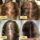 Natural Hair Growth Oil, Organic Natural Hair Growth Oil 60ml