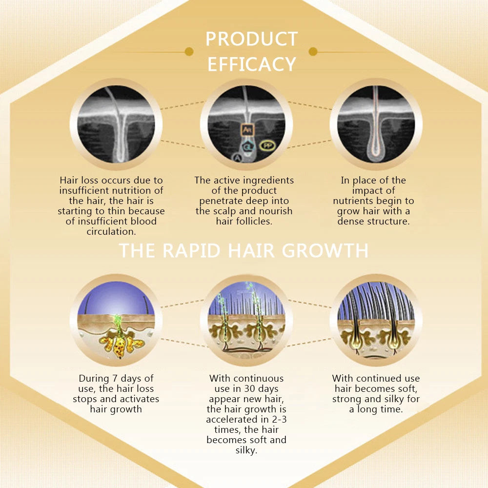 Andrea Hair Regrow Oil Growth Ginger Essence Hair Loss Serum Treatment 5x20ml