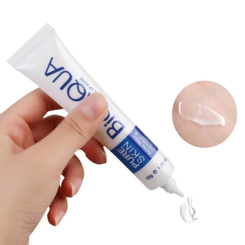 Bioaqua bioaqua Crema De Acné Removedor De Cicatrices Poros Blanqueadora Piel Facial Tratamiento